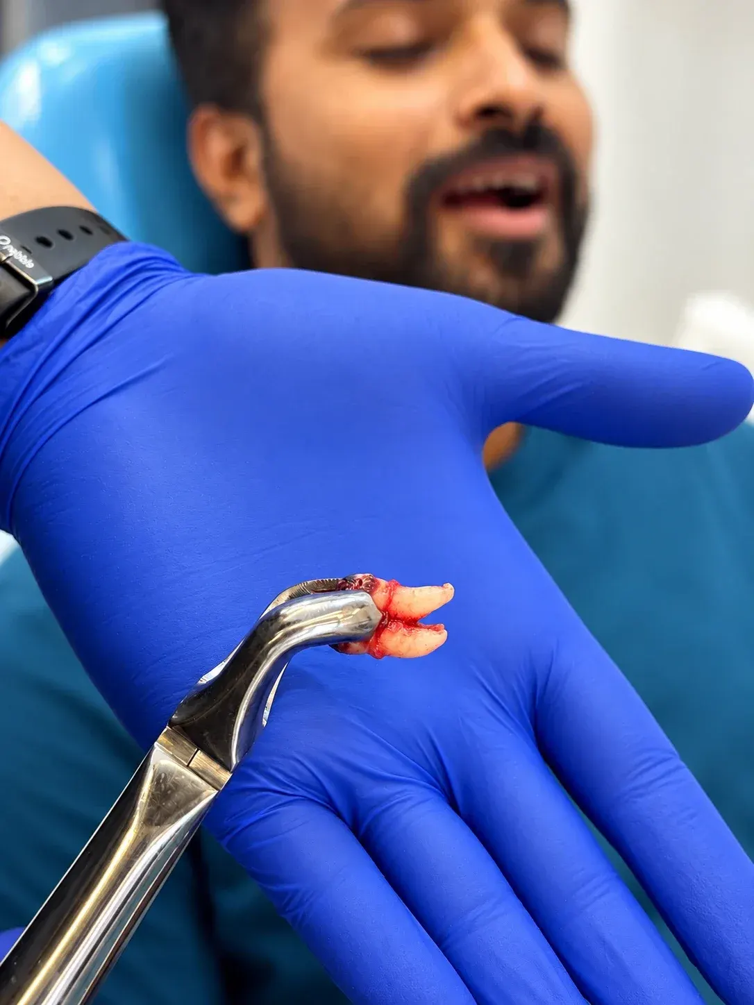 A dentist showing a patient the tooth that was removed, at Roots & Pulp