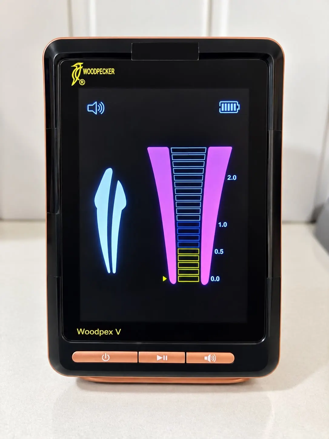 Electronic apex locator showing a root canal length reading
